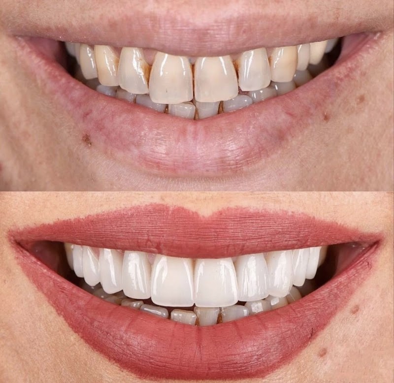 Odonto Calm - foto 2