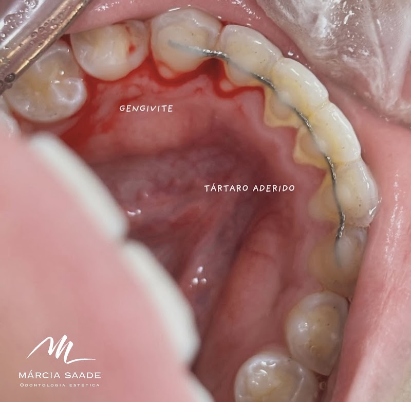Dra Márcia Saade Odontologia Estética e Preventiva - Dentista Itaim Bibi - foto 5