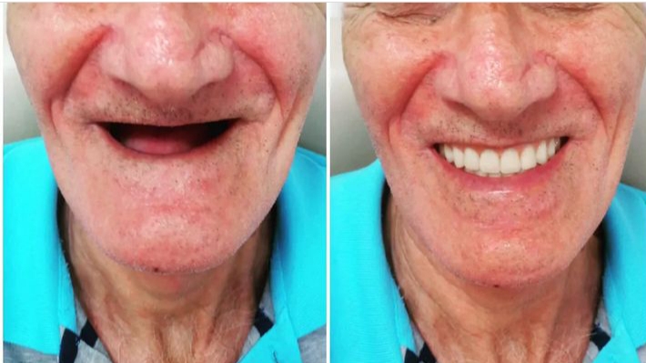 Odonto Aliados Campo Grande RJ | Dentista Campo Grande RJ | Dentista Popular em Campo Grande RJ - foto 2