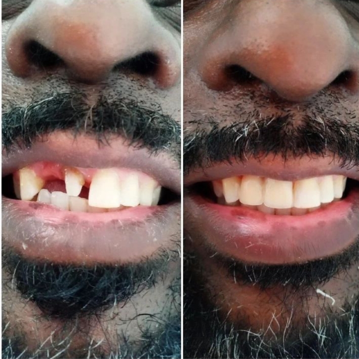 Odonto Aliados Campo Grande RJ | Dentista Campo Grande RJ | Dentista Popular em Campo Grande RJ - foto 5