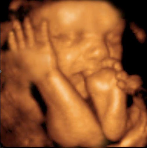 Peek a Belly 3D, Inc