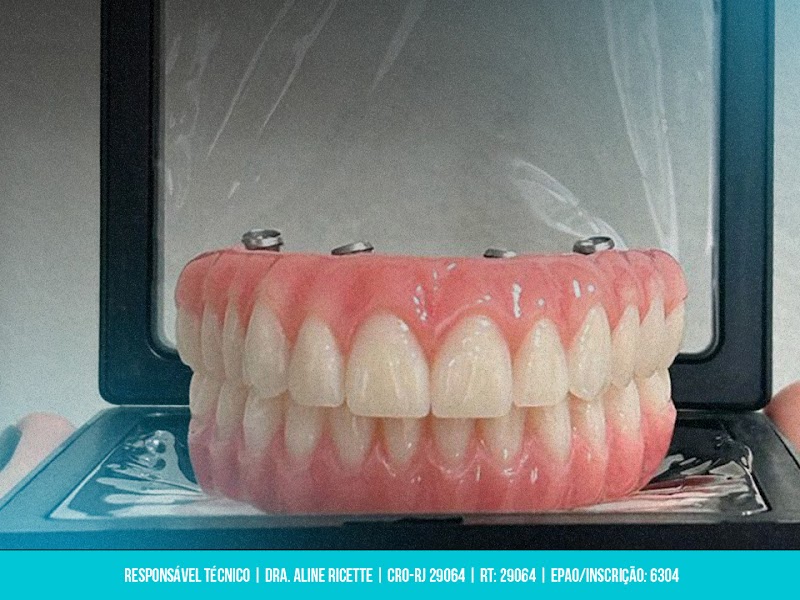 R7 Implantes Dentários e Prótese Protocolo | Dentista no Catete Rio de Janeiro - RJ - foto 5