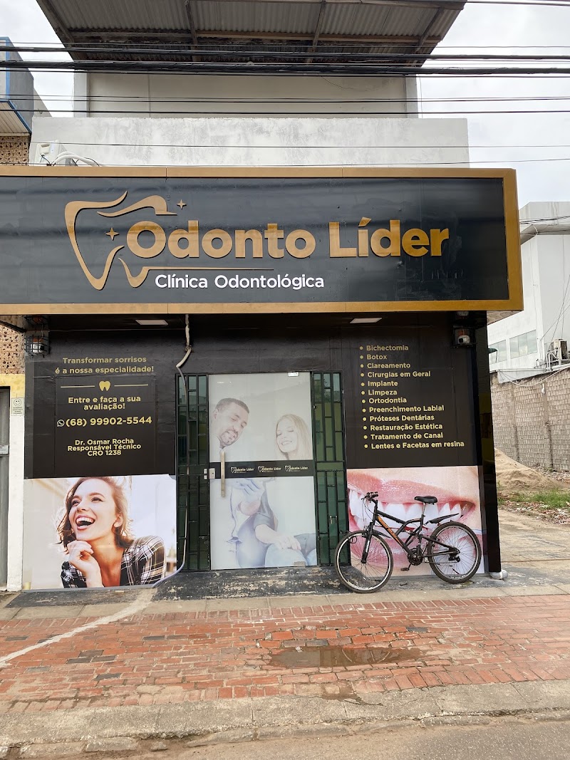 Clínica Odonto Líder | Dentista | Implante | Lentes em Resina Rio Branco AC - foto 3
