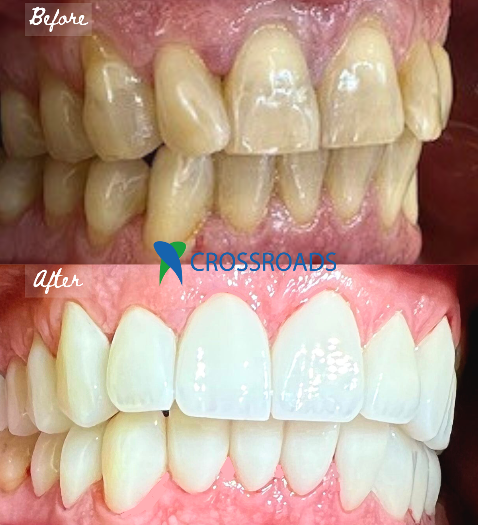 Crossroads Dental Clinic - Sheikh Zayed Road, Dubai 3