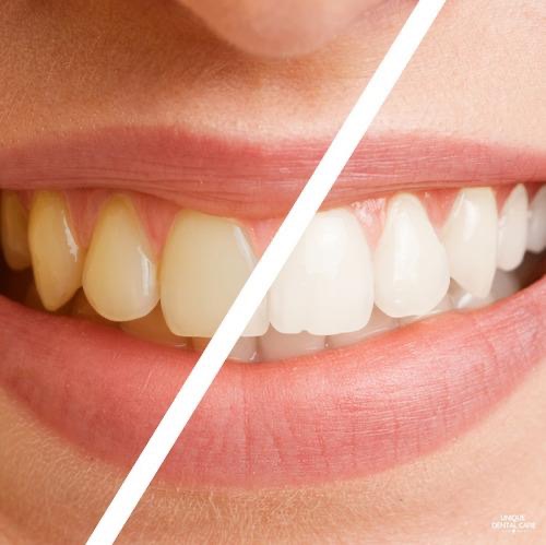 Dr Alan Ramos | ARO Odontologia - foto 4