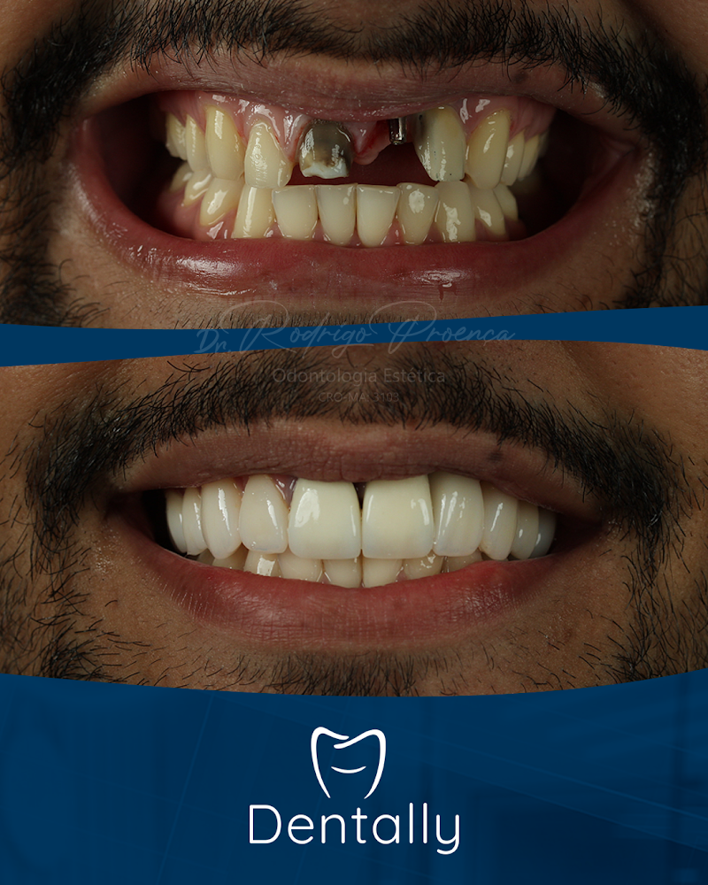 Dentally Especialidades Odontológicas - São Luís - foto 5