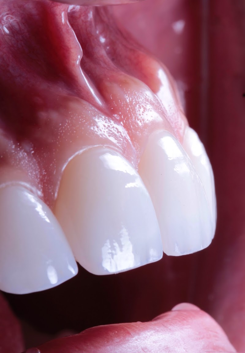 Brasil Implantes - Odontologia e estética facial - foto 4