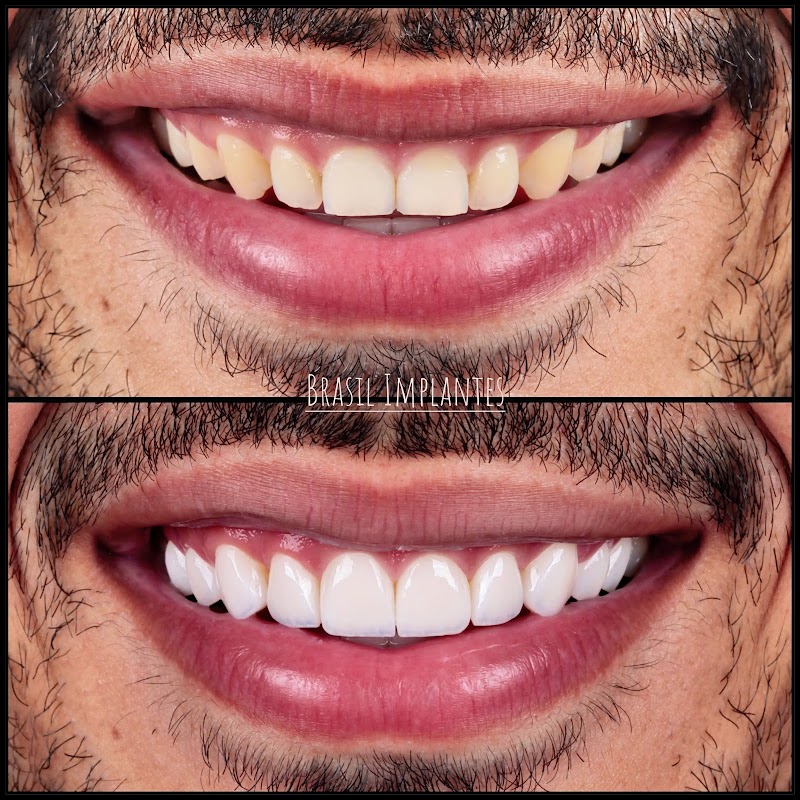 Brasil Implantes - Odontologia e estética facial