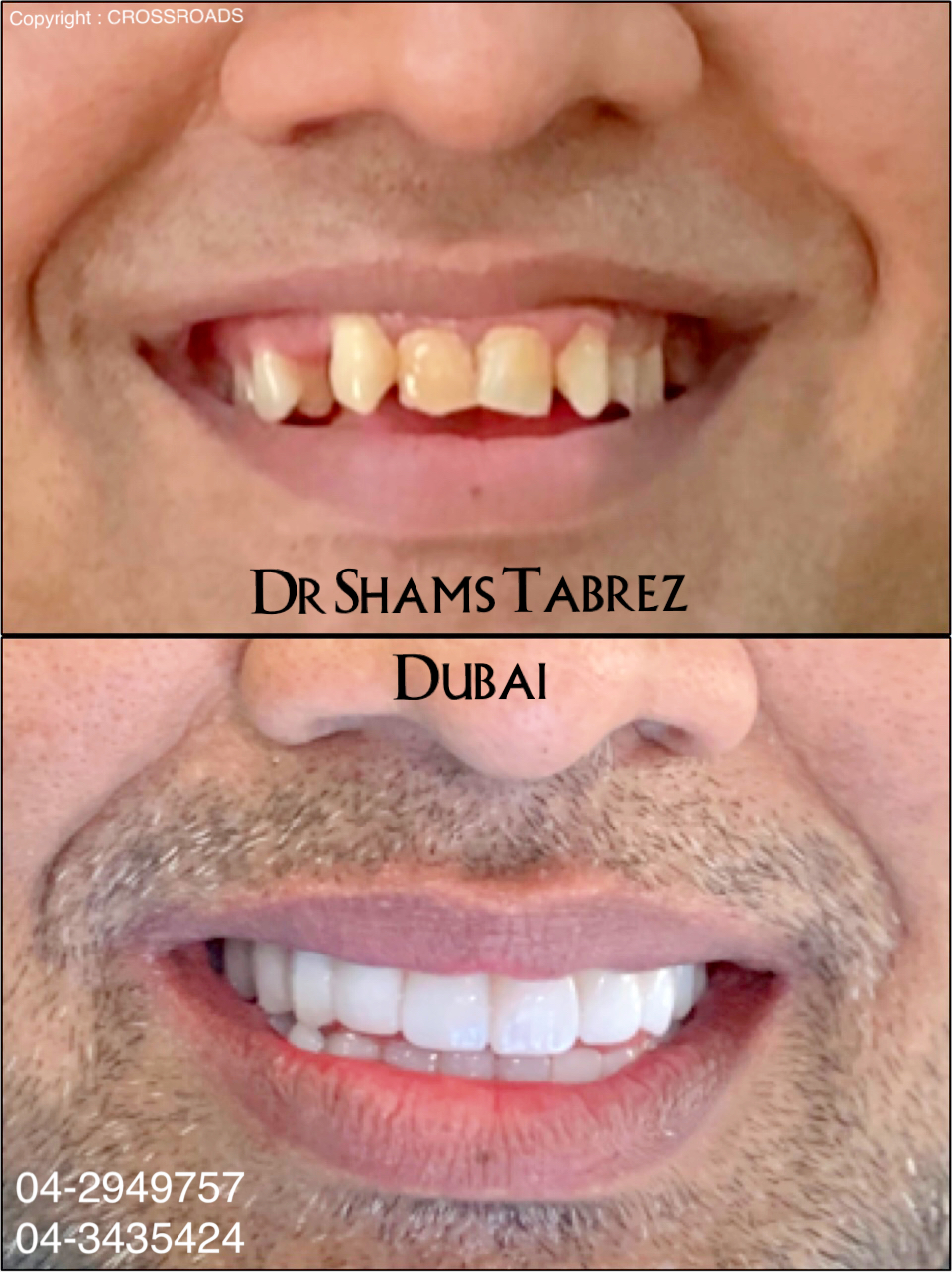Crossroads Dental Clinic - Deira, Dubai 2