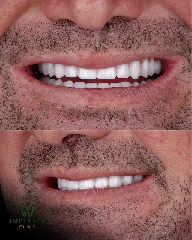 Implante Clinic - Botox - Implantes Dentários - Harmonização Facial - Goiânia - foto 2