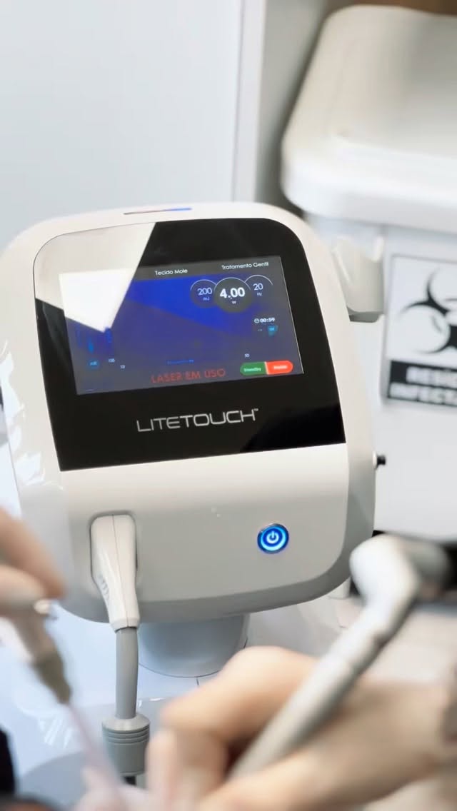 Simioni Odontologia - Implante e Lente de Contato Dental - foto 4