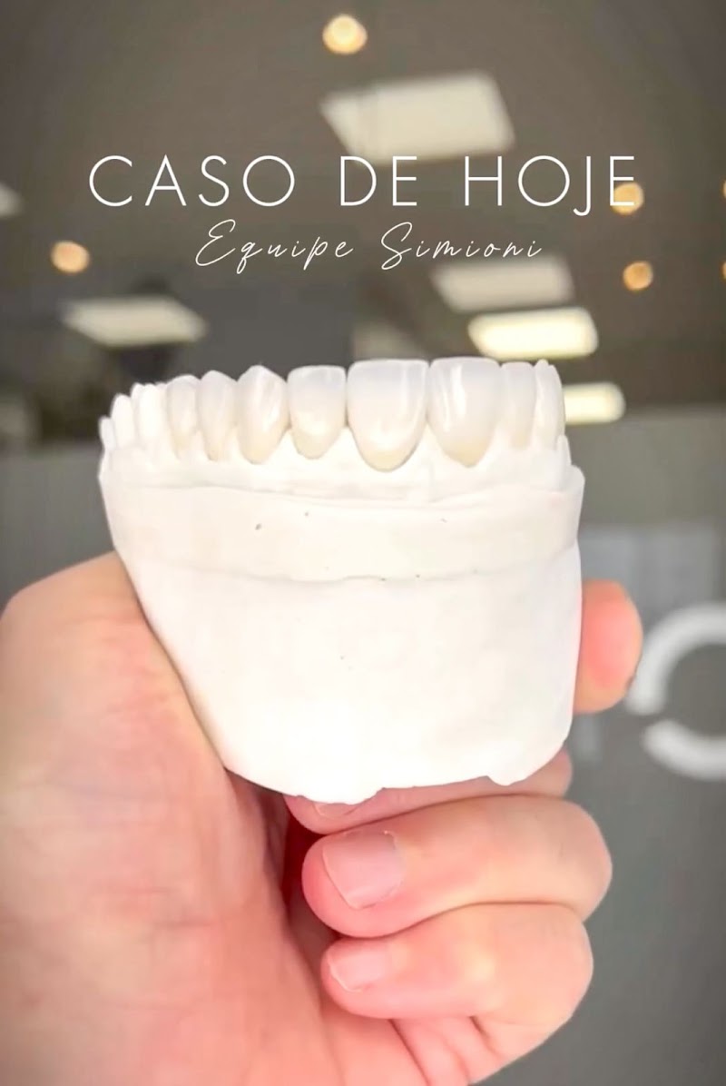 Simioni Odontologia - Implante e Lente de Contato Dental - foto 3