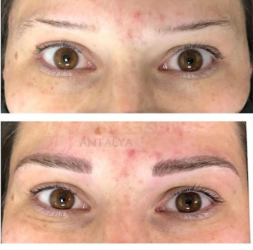 Hair Legends | Hair Transplant Antalya logo