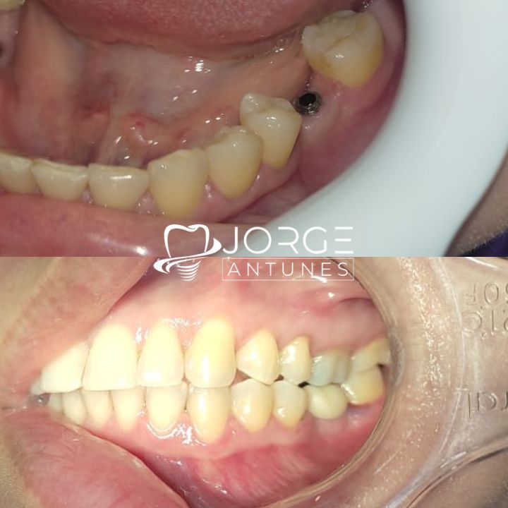 Dr Jorge Antunes | Implante Dentário Uberlândia - foto 3