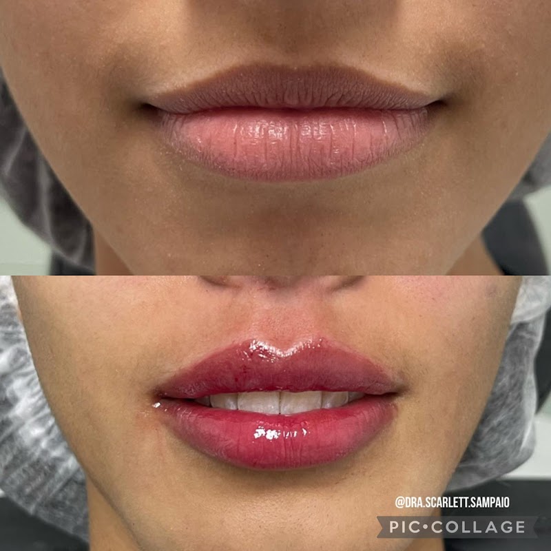 Dra.Scarlett Sampaio Harmonização Facial - foto 1