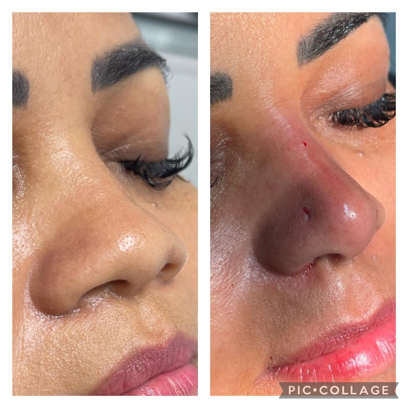 Dra.Scarlett Sampaio Harmonização Facial - foto 4