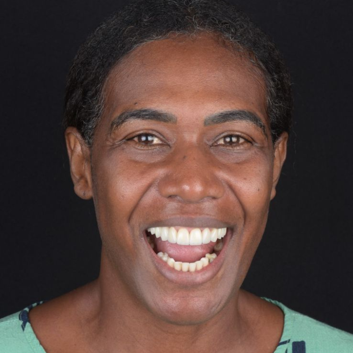 Dr. Gean Carlos - Dentista em Brasília: Dentista em Ceilândia | Implante Dentário | Prótese Dentária | Clareamento Dental - foto 5