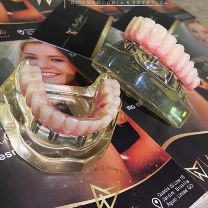 Dr. Gean Carlos - Dentista em Brasília: Dentista em Ceilândia | Implante Dentário | Prótese Dentária | Clareamento Dental - foto 2