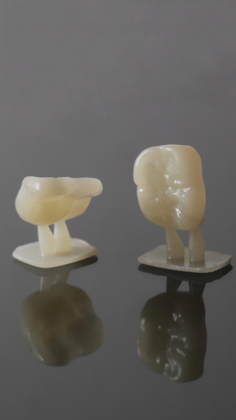 OX Odontologia de Excelência | Lente de Contato | Implante | invisalign | Prótese | Protocolo | Dentista Campo Grande - foto 4