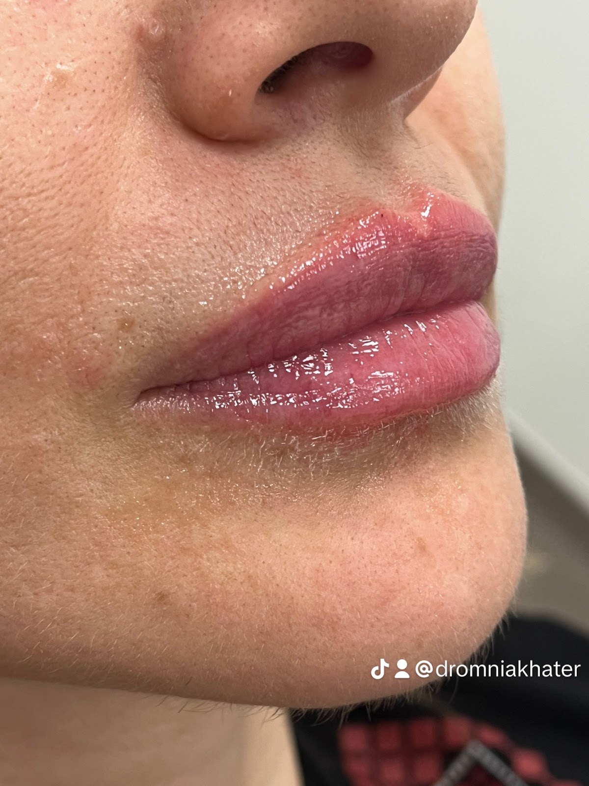 Dermatologist Dr. Omnia Khater 5