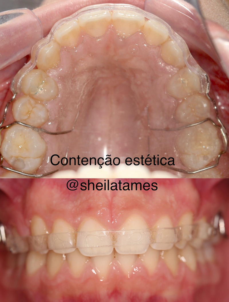 Ortodontia Sheila Foppa A. Tames Jurerê - foto 4