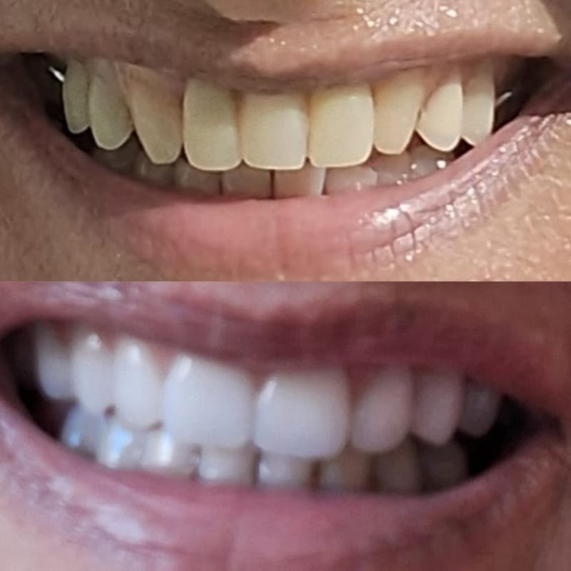 DF Implantes - Odontologia Especializada - foto 4