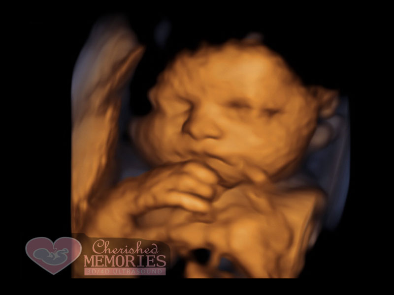 Mothers Precious Moments - 4D HDLive Ultrasound Cherished Memories