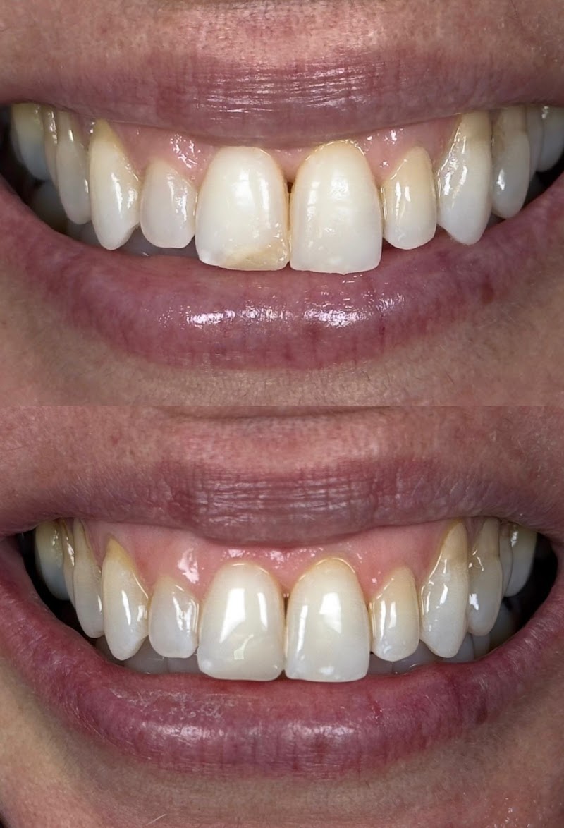 Dra. Izabella Mello | Dentista em Natal | Urgência Odontológica 24h | Dentista 24h - foto 2
