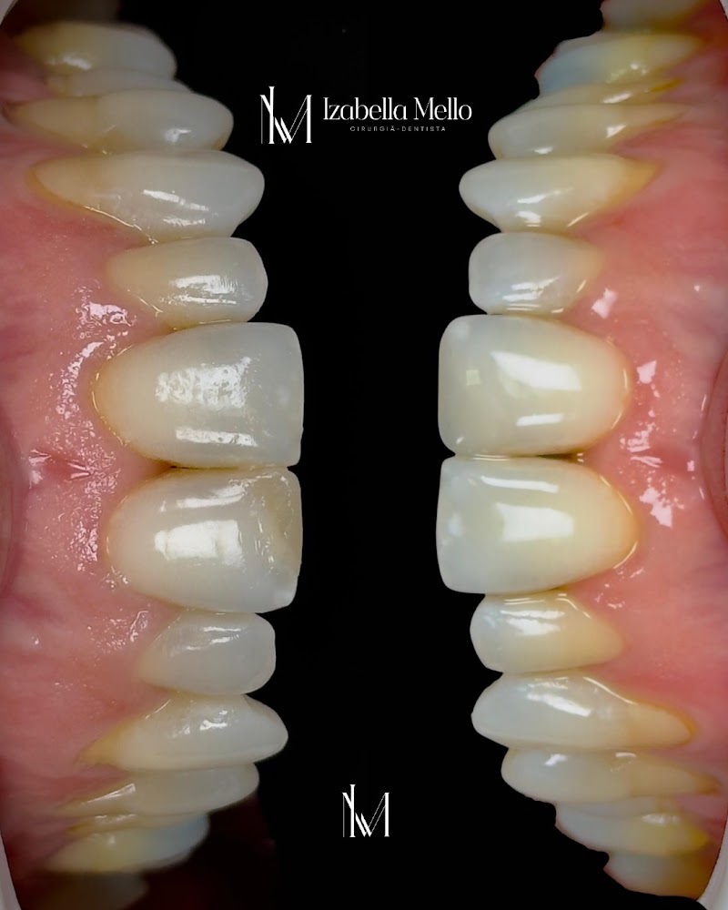 Dra. Izabella Mello | Dentista em Natal | Urgência Odontológica 24h | Dentista 24h - foto 4