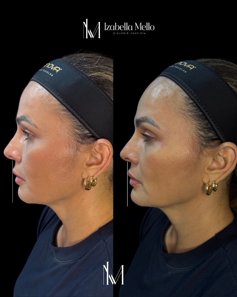 Dra. Izabella Mello | Dentista em Natal | Urgência Odontológica 24h | Dentista 24h - foto 3