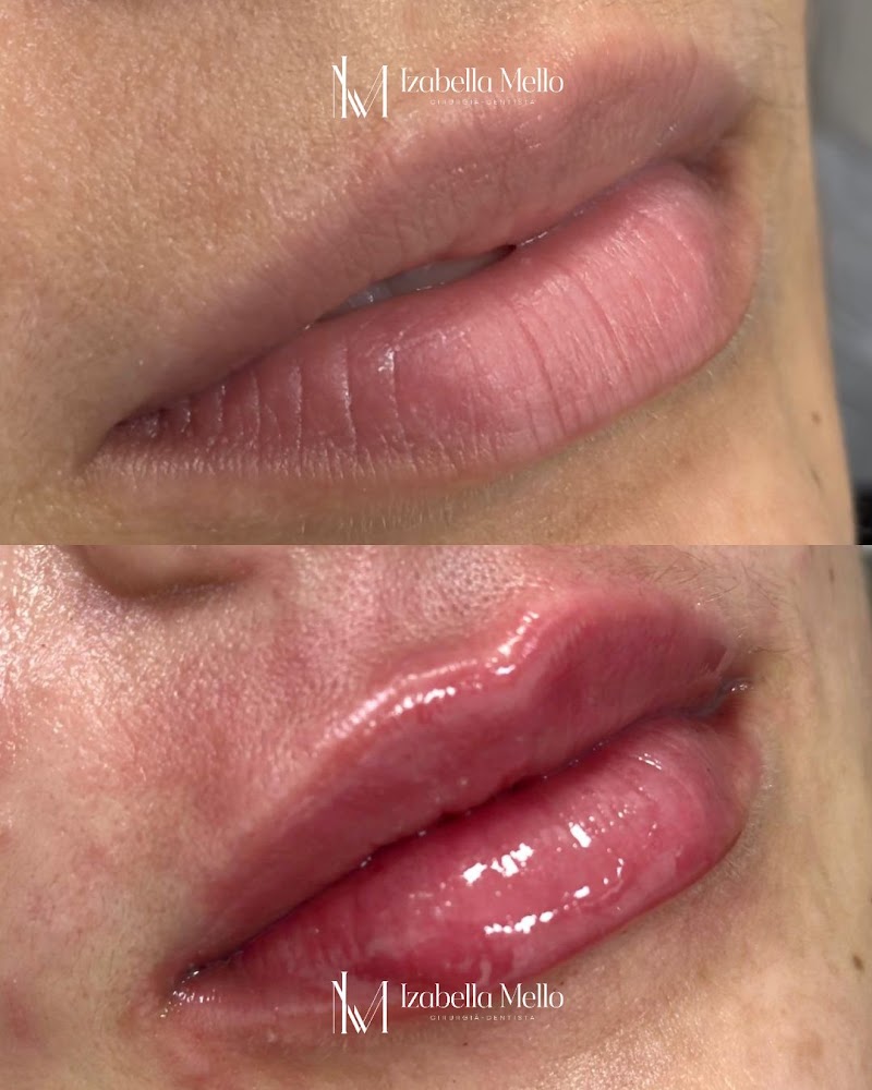 Dra. Izabella Mello | Dentista em Natal | Urgência Odontológica 24h | Dentista 24h - foto 5