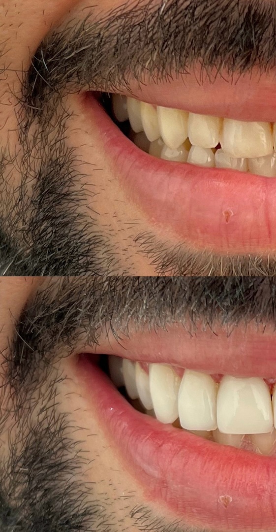 Dra Suzana Guerta - Cirurgiã-Dentista em Volta Redonda