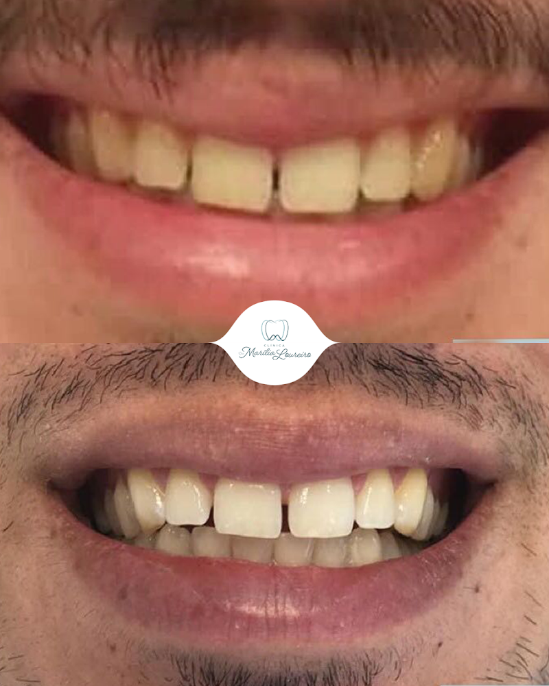 Dra. Marília Loureiro | Implantes e Próteses Dentárias - foto 5