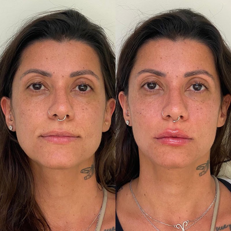 Dra. Flávia Queiroz e Dra. Larissa Corteletti - Odontologia e harmonização facial | Copacabana, Zona Sul RJ - foto 2