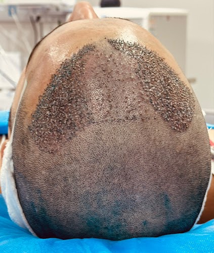 Érica Vilhena | Transplante Capilar| Queda Cabelo| São Paulo logo