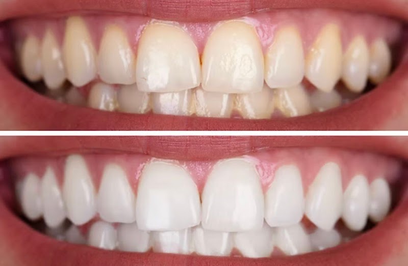 Dr.Bruno Roriz - Cirurgião Dentista - foto 2