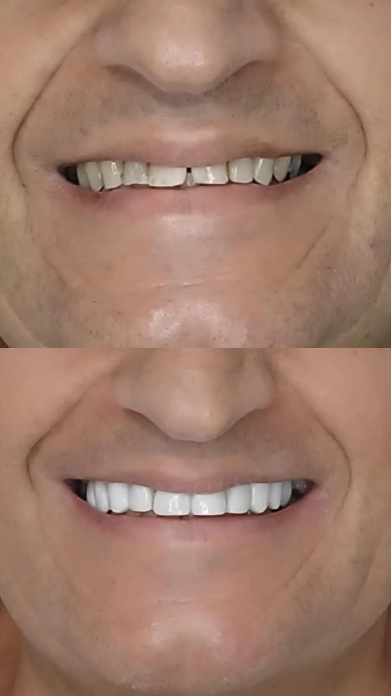 Dr. Jefferson Lopes | Dentista em Natal - prótese, implante dentário, clareamento dental, facetas. Clínica odontológica. - foto 5