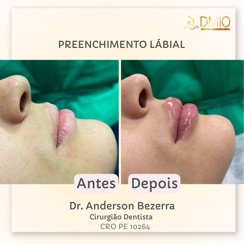 DMIO CLINICA / Dr. Daniel Maior e Dr. Anderson Bezerra - foto 5