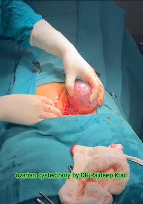 Dr Rajdeep Kour / Best Gynecologist Doctor in jamshedpur - Image 3