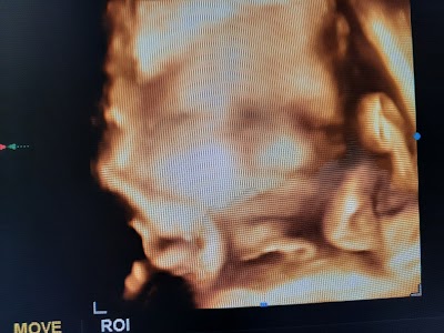 Dr Lopamudra Jena Ultrasound