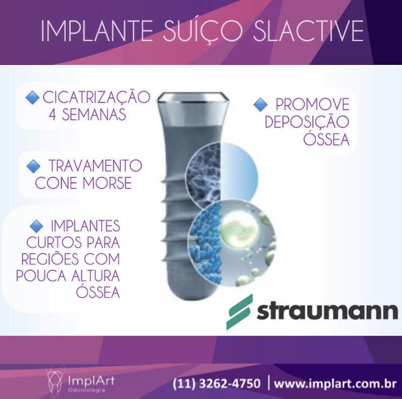 ImplArt Odontologia Implante Dentario - foto 3