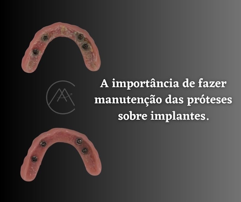 Dentista em Sorocaba - Dr. Mateus Feitosa - foto 4