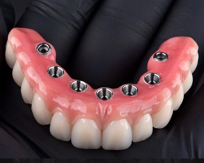 Dra. Daniella Auday: Especialista em Implantes e Próteses Dentárias na Clínica de Referência - foto 4