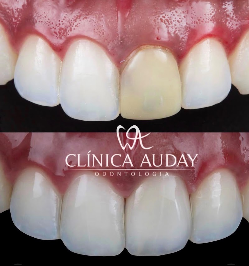 Dra. Daniella Auday: Especialista em Implantes e Próteses Dentárias na Clínica de Referência - foto 2