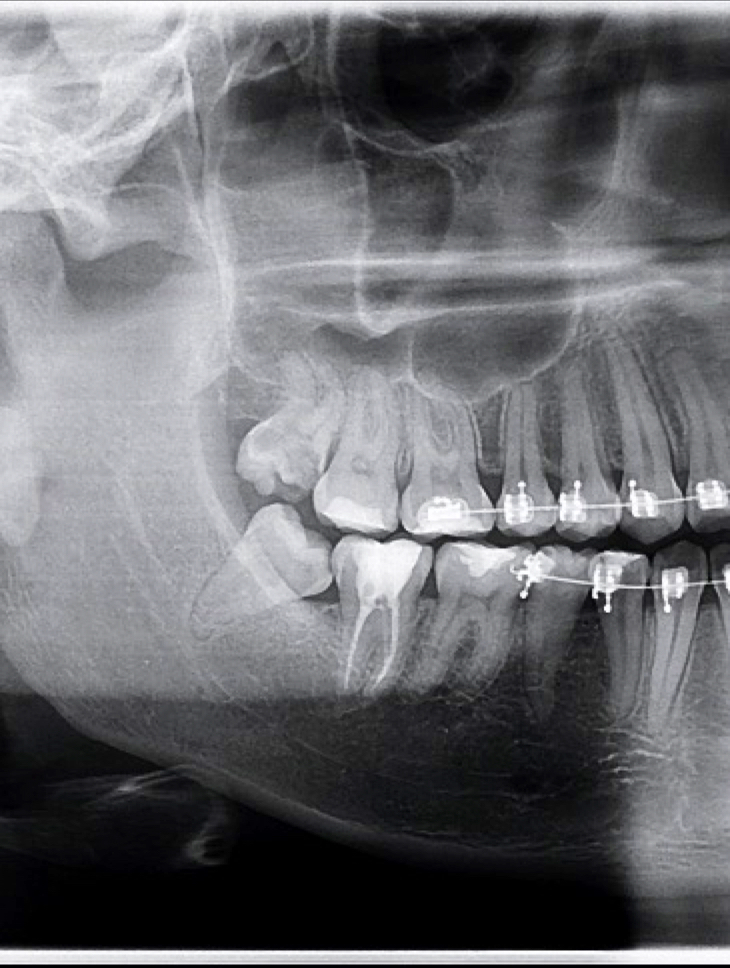 Dentista em Cuiabá - Dra. Maria Elisa Rosa - foto 3