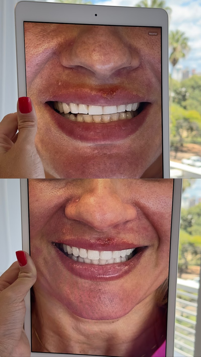 Dra Jéssica Soares | Consulta | Bruxismo | Facetas | Clareamento| Restauração| Revisão |Periodontia DENTISTA PORTO ALEGRE - foto 2