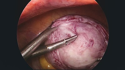 Dr Mangirish Kenkre ( Gynecologist and Laparoscopy Surgeon) - Image 3