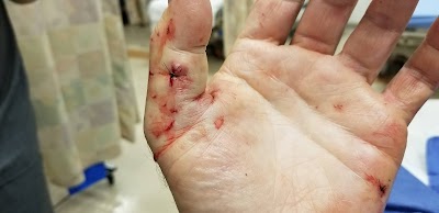 Sweet James Accident Attorneys - Car accident lawyer in Encino