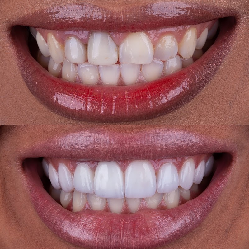 Dra. Marina Amarante Lente de Contato Dental - foto 4