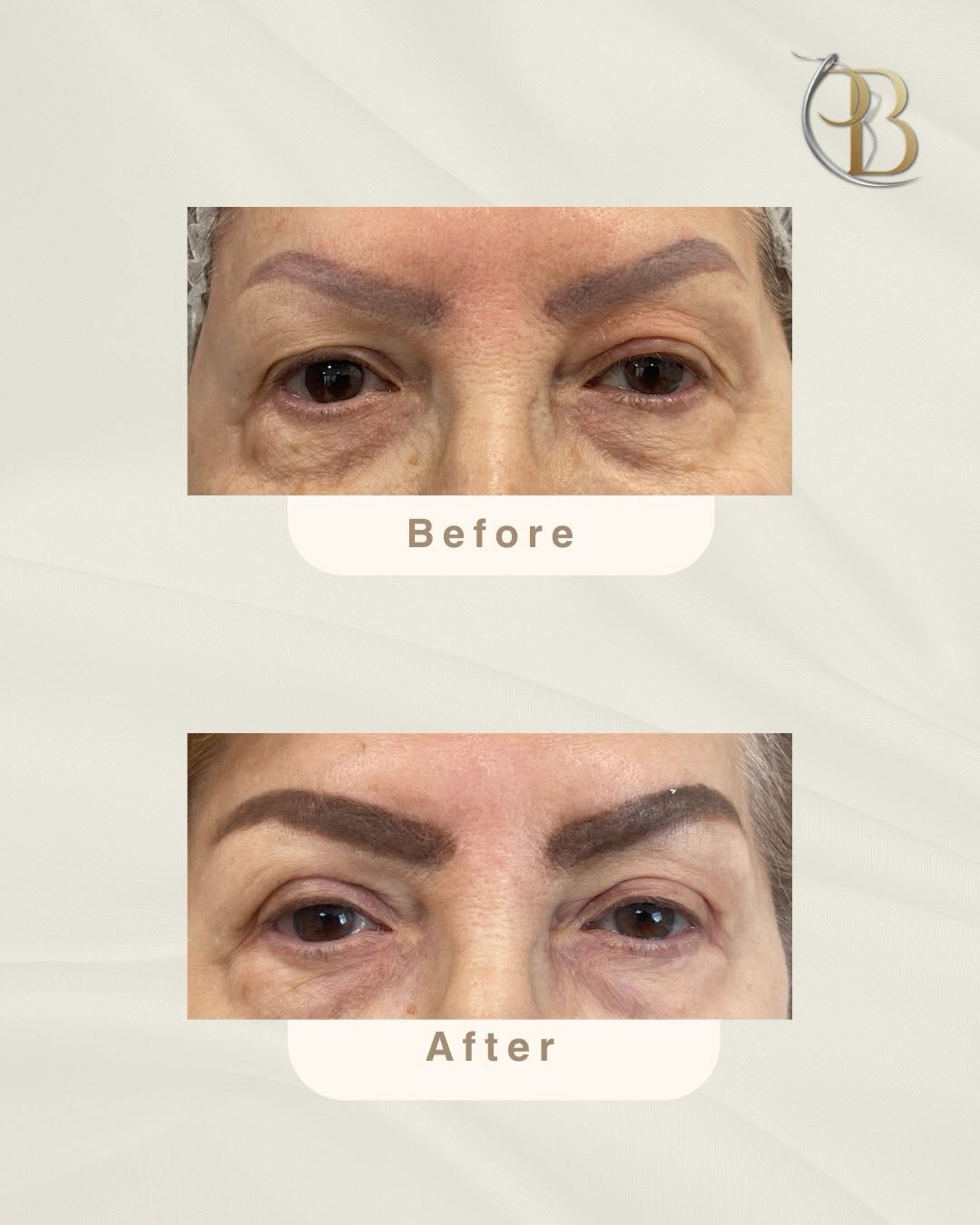 Plastic Surgery By Doctor Punam Bijlani 3